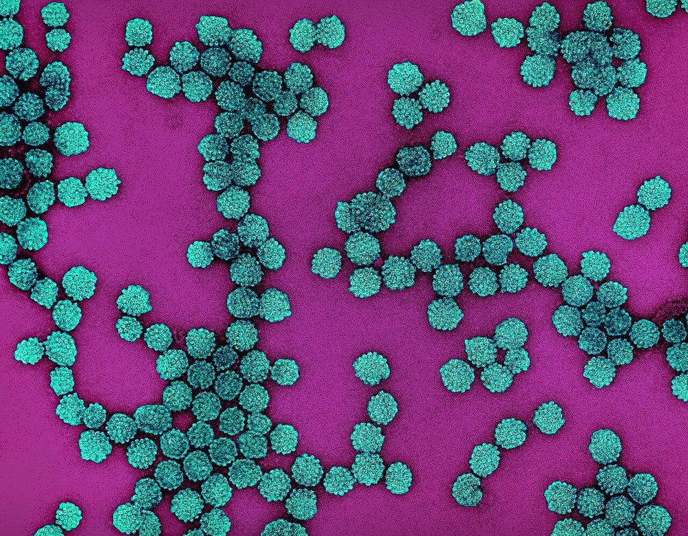 Colourised electron micrograph of HPV particles — scientific context