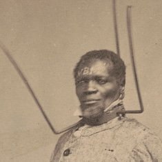 Wilson Chinn wearing an iron collar — a different photograph from the Gailliard demonstration discussed here